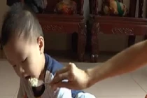 Dinh dưỡng cho trẻ mắc sởi: Những điều cần biết