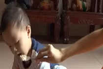 Dinh dưỡng cho trẻ mắc sởi: Những điều cần biết