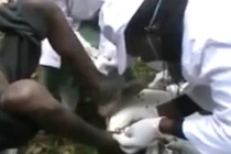 Kinh hãi lấy bọ chét khỏi bàn chân người