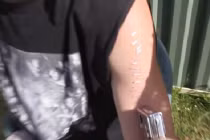 Trai trẻ bị bắn tới tấp đinh ghim vào người