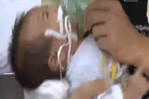 Thêm hai trường hợp tử vong vì bệnh sởi