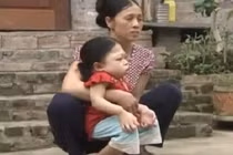 Bệnh lạ khiến người giống ếch ở Hà Nội