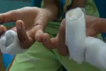 Đồ chơi Trung Quốc phát nổ, bé trai đứt tay, hỏng mắt