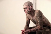 Cuộc đời bi thảm của thanh niên “xác sống” duy nhất trên thế giới