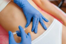 Hàng chục bệnh nhân bị ngộ độc sau tiêm botox dạ dày để giảm cân