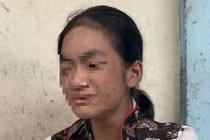 Bà chủ đánh đập dã man và bắt bé gái ăn thằn lằn sống khai gì?