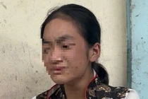 Bà chủ đánh đập dã man và bắt bé gái ăn thằn lằn sống khai gì?