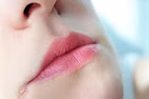 Nhận biết bệnh tật qua biểu hiện của đôi môi
