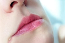 Nhận biết bệnh tật qua biểu hiện của đôi môi