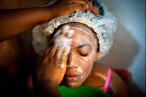 Bộ ảnh người châu Phi đua nhau tẩy trắng da