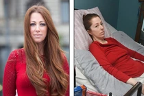 Quý bà phải nằm liệt giường vì bị...ve đốt