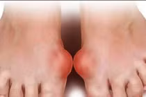 Nhìn xuống bàn chân thấy 6 dấu hiệu này cần đi khám ngay, đừng để lâu mà hối không kịp