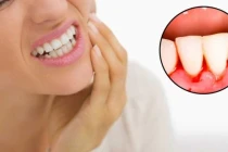 Sáng nào ngủ dậy cũng thấy 3 dấu hiệu này thì 80% gan đã "cứng như đá" phải đi khám ngay