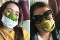 Cách tránh và ngăn ngừa say tàu xe để khỏe re về quê ăn Tết