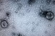 "Virus gây bệnh Covid-19 ở Việt Nam đã tiến hóa"