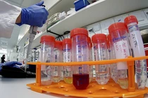 ĐSQ Việt Nam tại Trung Quốc: Chưa ghi nhận có lưu học sinh nhiễm virus corona