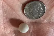 Ăn món khai vị bất ngờ phát hiện viên ngọc trai đắt giá