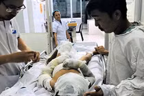 Dì tưới xăng đốt cháu: Chửi thề rồi đổ xăng lên đốt