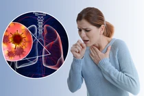 Bác sĩ mách cách tránh ho, đau họng khi thời tiết giao mùa