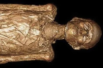 Căn bệnh kinh khủng trên xác ướp Ai Cập cổ đại