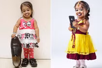 Top 10 người thấp nhất thế giới là ai?