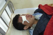 Đầu năm, nhân viên xe buýt lại bị đánh nhập viện