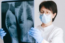  Mắc bệnh chết người vì thói quen thắp 20 nén hương mỗi tuần