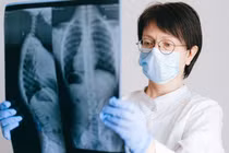  Mắc bệnh chết người vì thói quen thắp 20 nén hương mỗi tuần