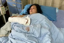 Kiên quyết muốn ly hôn, người phụ nữ bị chồng cầm dao đâm chém 