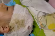 Trung Quốc: Hiệu trưởng đánh nam sinh 10 tuổi vỡ mạch máu não