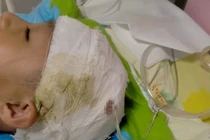 Trung Quốc: Hiệu trưởng đánh nam sinh 10 tuổi vỡ mạch máu não