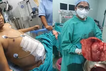 Kinh hãi khối u khổng lồ khiến người đàn ông như đang mang bầu