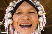 Tròn mắt những kiểu làm đẹp "dị" của phụ nữ trên khắp thế giới