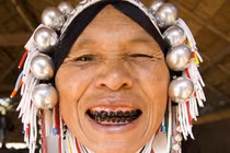 Tròn mắt những kiểu làm đẹp "dị" của phụ nữ trên khắp thế giới