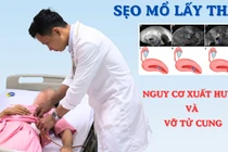 Sản phụ 40 tuổi thai bám ở sẹo mổ nguy hiểm tính mạng