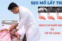Sản phụ 40 tuổi thai bám ở sẹo mổ nguy hiểm tính mạng