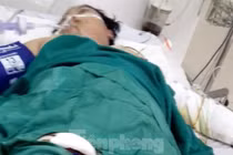 Chồng tưới xăng lên vợ mang bầu 8 tháng rồi châm lửa đốt