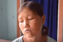 Video: Cô gái nặng 25kg ăn 5 lon gạo, uống 10 lít nước mỗi bữa 