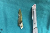 Ăn bánh canh ốc móng tay, người đàn ông ở Cần Thơ bị thủng ruột