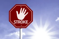 Đột quỵ nặng thì tử vong, nhẹ thì tàn tật, phòng ngừa thế nào?