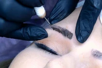 Bác sĩ chỉ ra nguyên nhân sốc phản vệ khi phun xăm thẩm mỹ