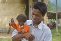 Lạ lùng những căn bệnh từ hôn nhân cận huyết ở Việt Nam