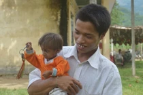 Lạ lùng những căn bệnh từ hôn nhân cận huyết ở Việt Nam