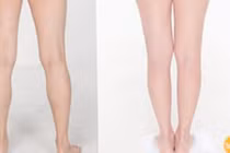 Video: Tuyệt chiêu giảm mỡ đùi cực nhanh