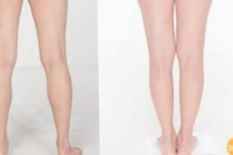 Video: Tuyệt chiêu giảm mỡ đùi cực nhanh