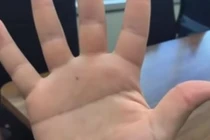 Video: Sở hữu nét tướng này, bạn thuộc nhóm dân số cực kỳ hiếm