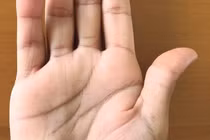 Đến nha sĩ kiểm tra đơn giản, tá hỏa phát hiện nhiễm trùng có thể tử vong 