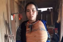 Khối u khổng lồ như quả mít 12 năm trên ngực cô gái ở Yên Bái