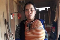 Khối u khổng lồ như quả mít 12 năm trên ngực cô gái ở Yên Bái