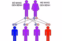 9 căn bệnh di truyền thường gặp ở người